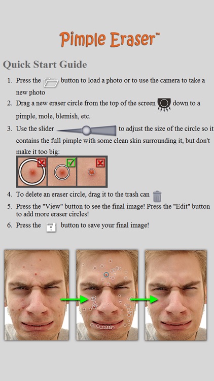 Pimple Eraser screenshot-4