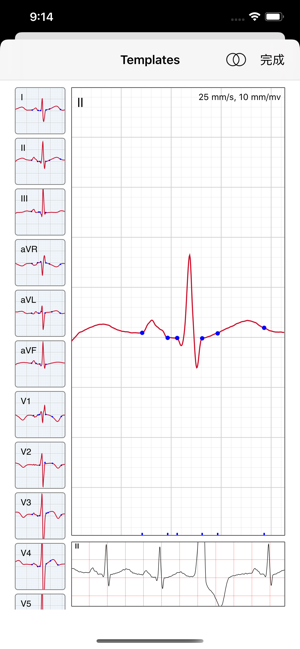 ECG / EKG(圖6)-速報App