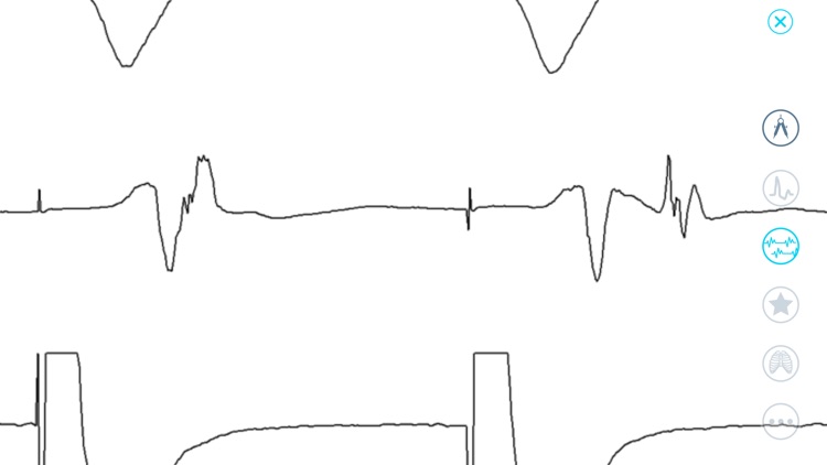 Cardiac Arrhythmia Challenge screenshot-7