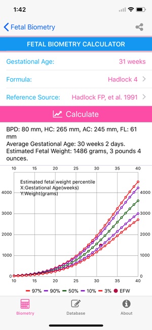 Fetal Ultrasound(圖5)-速報App