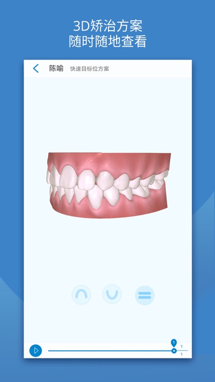 iOrtho - 时代天使数字化正畸智能服务平台 screenshot-3
