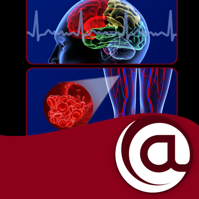 Stroke Prevention in AFib @PoC