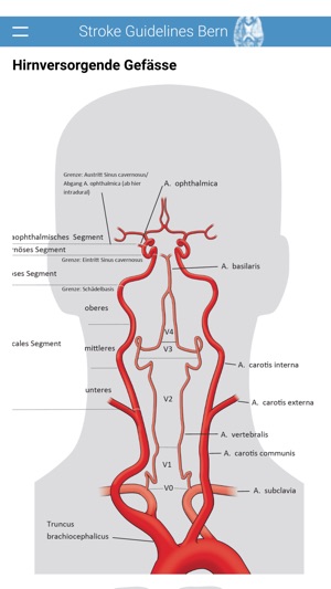 Stroke Guidelines Bern(圖4)-速報App