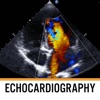 Echocardiography Textbook mathematics textbook 