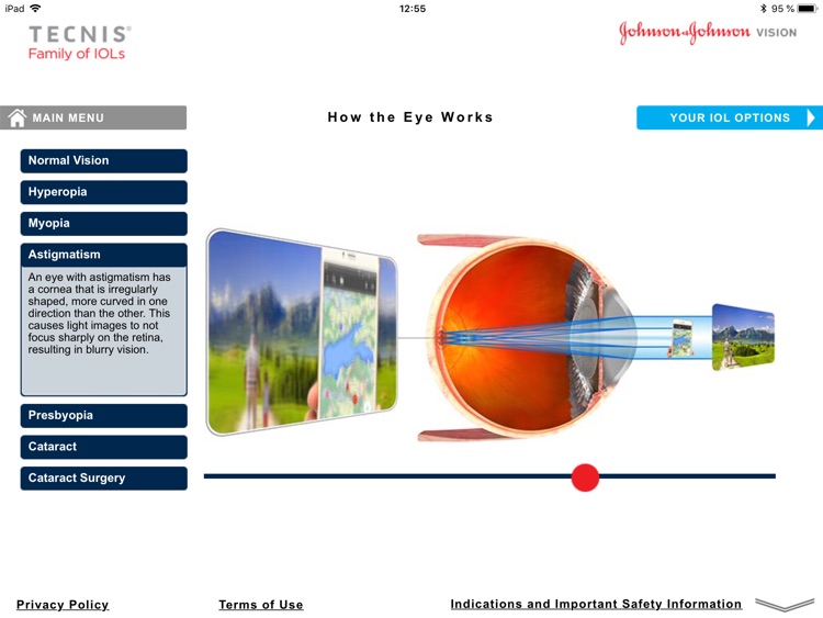 TECNIS® Vision Simulator