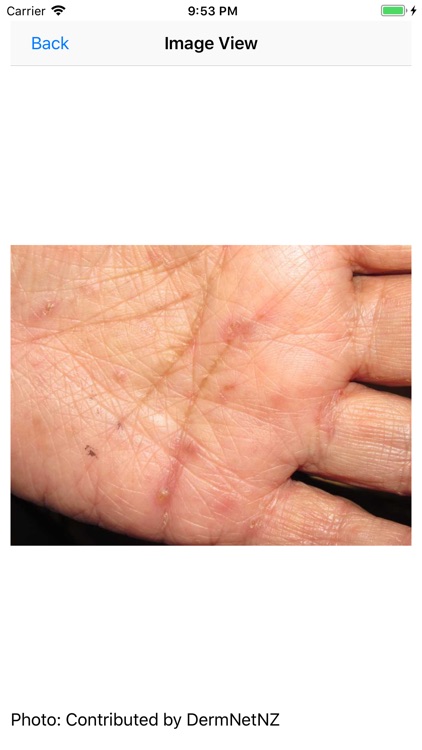 Infection Control Nurse (CIC)