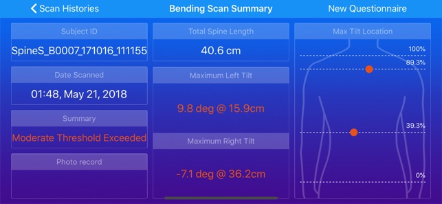 SpineScan3D(圖2)-速報App