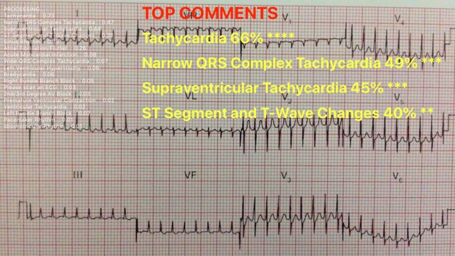 ECG Reader