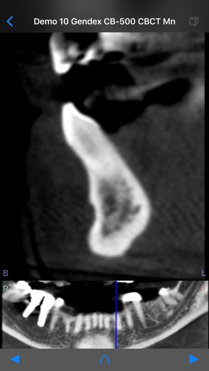 Dental CT View screenshot-5