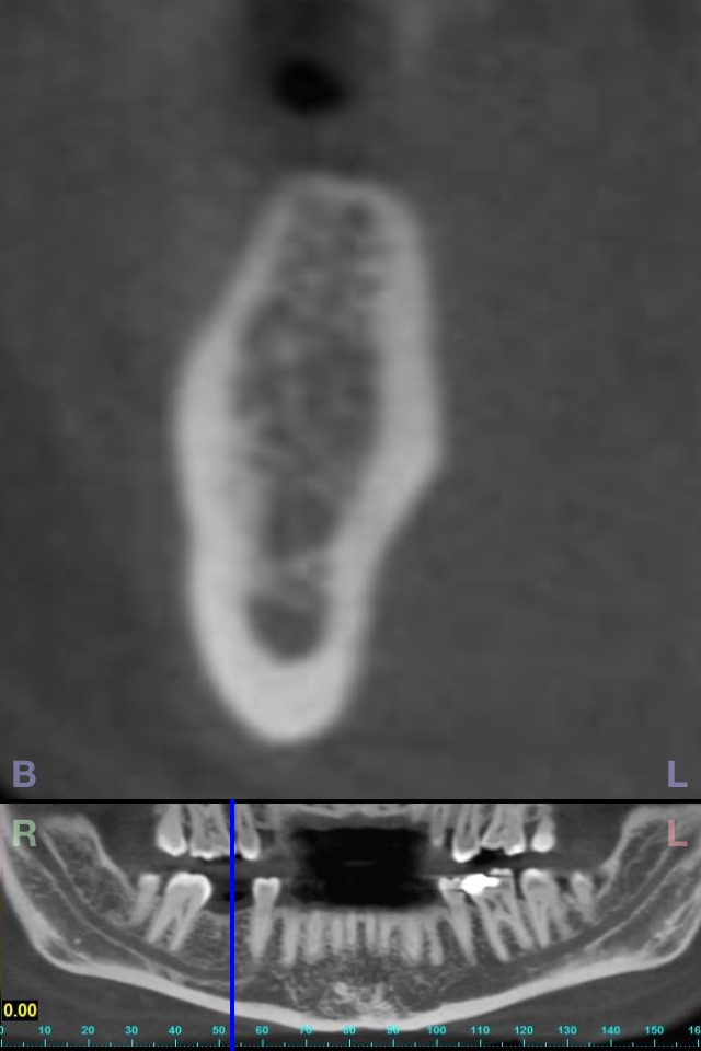 Dental CT View screenshot 4