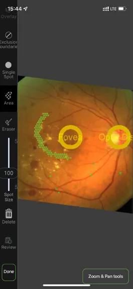 Game screenshot Navigate for Retina Experts apk