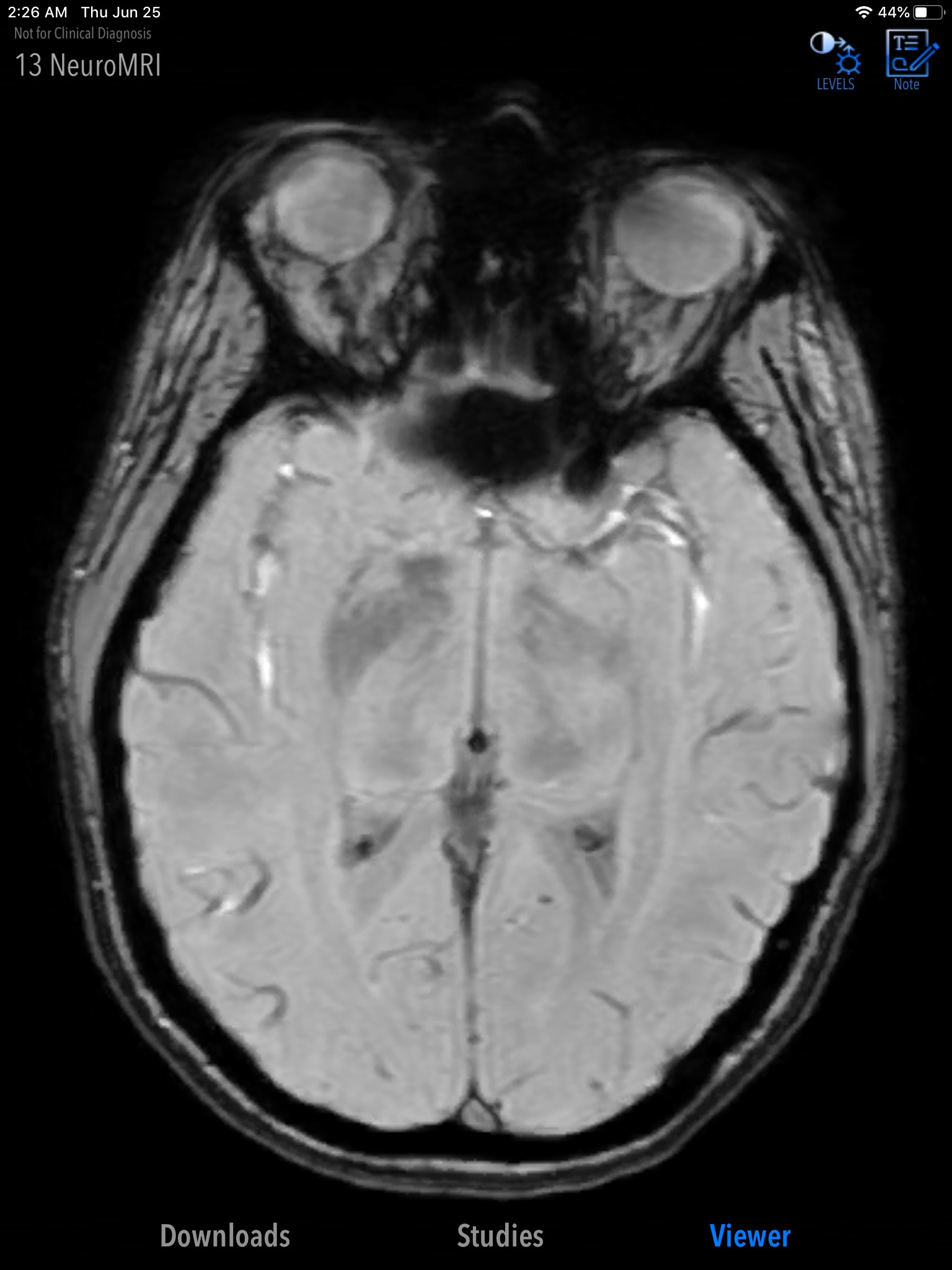 MedVizi™ CT-MRI Viewer screenshot 4