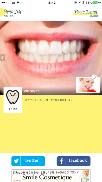 Smile Cosmetique  白い歯日記のおすすめ画像3