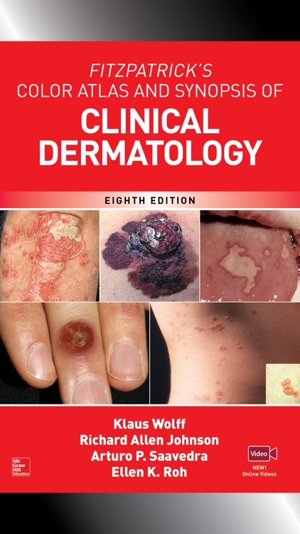 Fitzpatrick's Atlas & Synopsis of Dermatology, 8/E