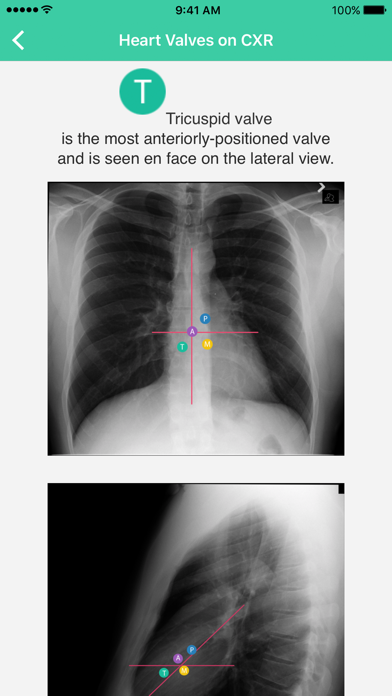 Radiology Toolbox Pro Screenshot 5