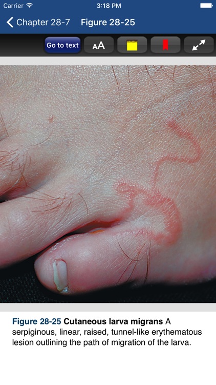Fitzpatrick's Atlas & Synopsis of Dermatology, 8/E screenshot-3
