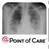 Idiopathic Pulmonary Fibrosis @Point of Care™