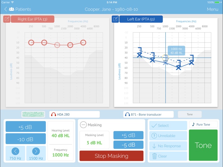 SHOEBOX Audiometry Pro