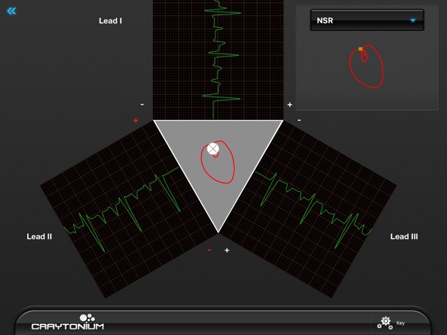 Craytonium ECG(圖3)-速報App