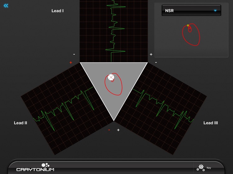 Craytonium ECG