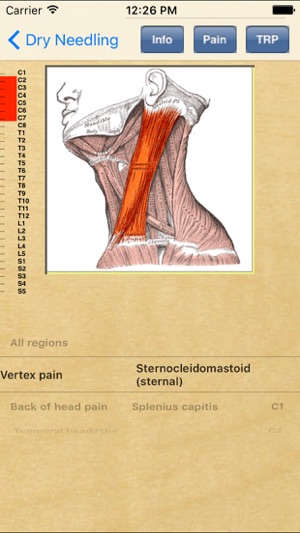 Dry Needling Therapy(圖4)-速報App