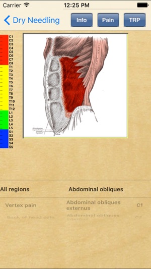 Dry Needling Therapy(圖5)-速報App