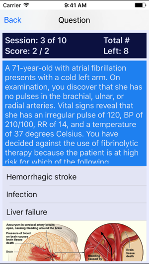 Progressive Care Nursing PCCN Review(圖5)-速報App