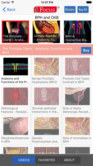 Animated Atlas of BPH and OAB(圖2)-速報App