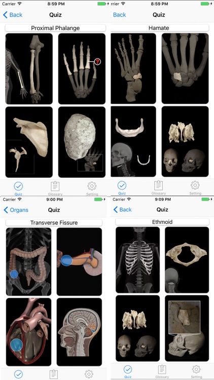Anatomy, Physiology Quiz and Glossary for iPhone screenshot-4