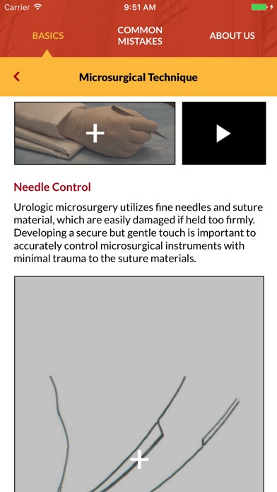 Male Infertility Microsurgery screenshot 4