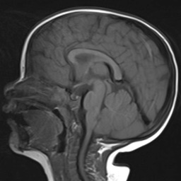 Myelination Brain