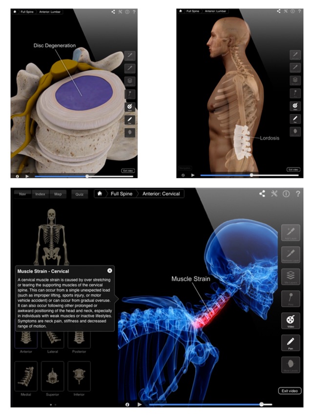 Spine Pro III(圖3)-速報App