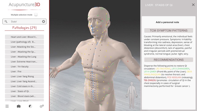 Acupuncture3D(圖6)-速報App