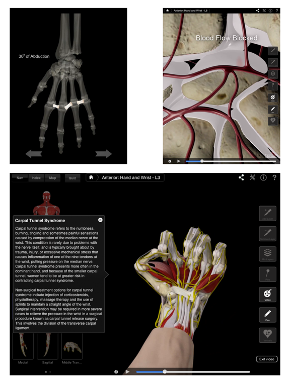Hand & Wrist Pro III for iPadのおすすめ画像2