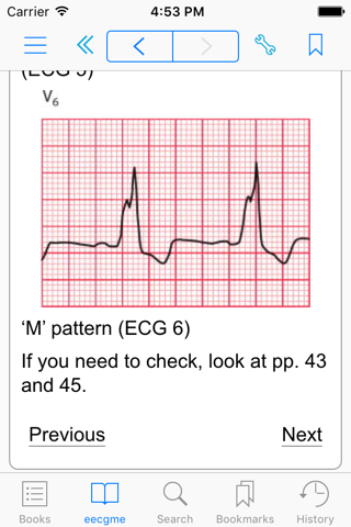 The ECG Made Easy, 8th Edition screenshot 3