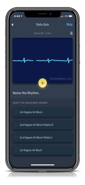 ACLS Rhythms and Quiz(圖5)-速報App