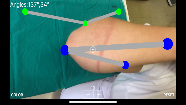 ARorthopaedicGoniometer(圖3)-速報App