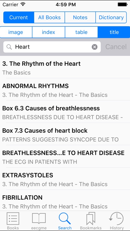 The ECG Made Easy, 8th Edition screenshot-3