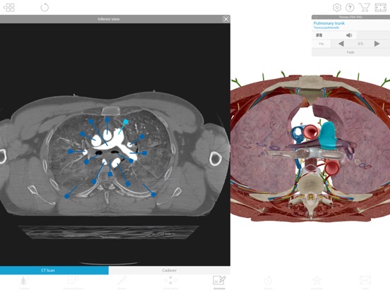 human atlas anatomy patch version 7.4.01