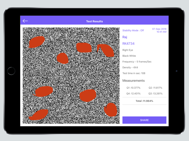 Visual Field Fast(圖4)-速報App