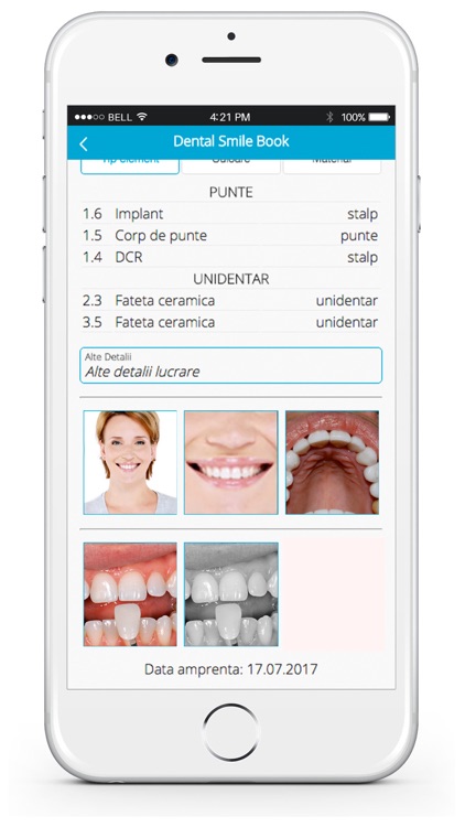 miioSMILE Lite