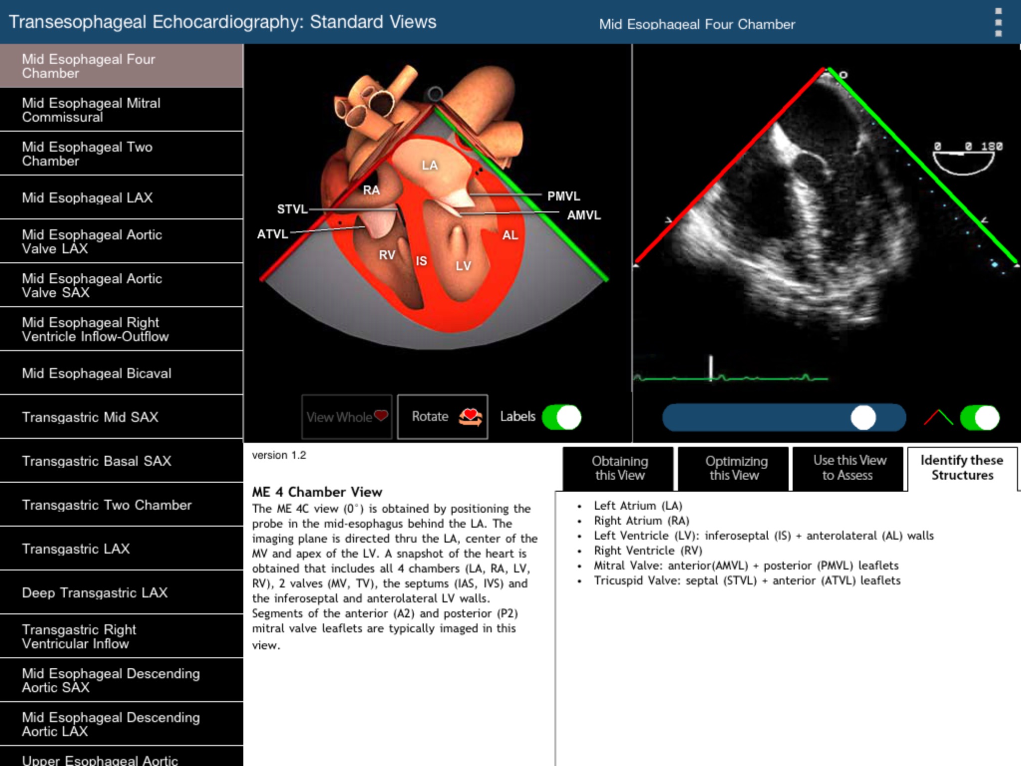 TEE Standard Views screenshot 3