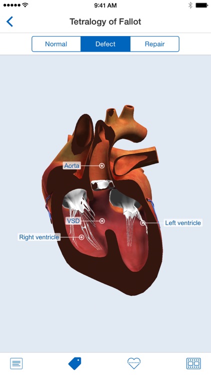 Heartpedia