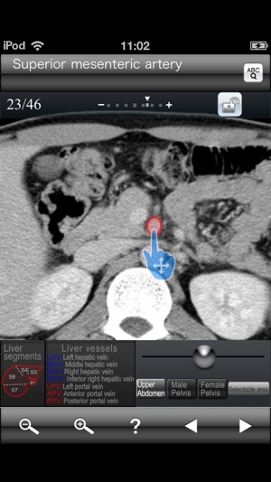 Abdominal CT Sectional Walker(圖1)-速報App
