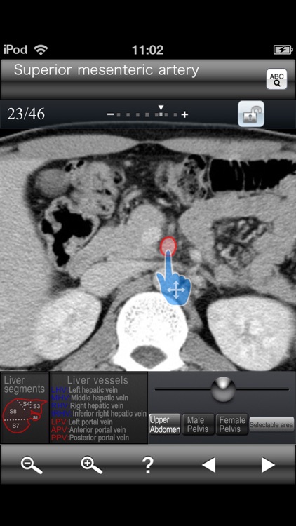 Abdominal CT Sectional Walker