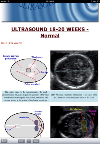 Ultrasoundpaedia screenshot 4