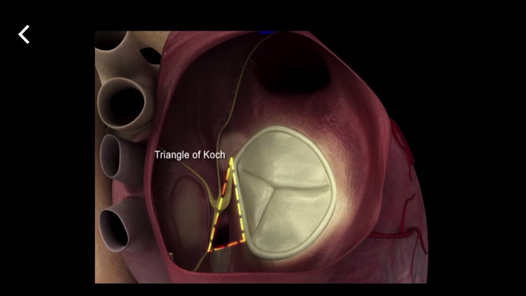 Mitral & Tricuspid Valves