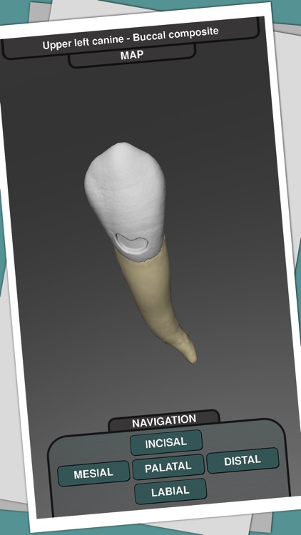 CavSim : Dental Cavity Preps