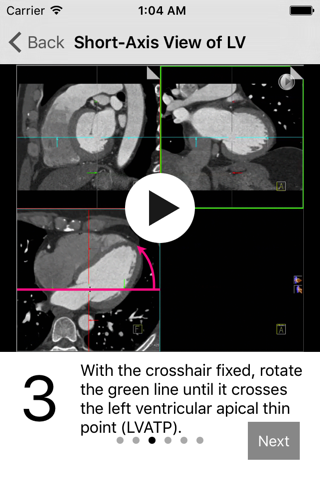 Cardiac Imaging Planes 1-2-3 - náhled