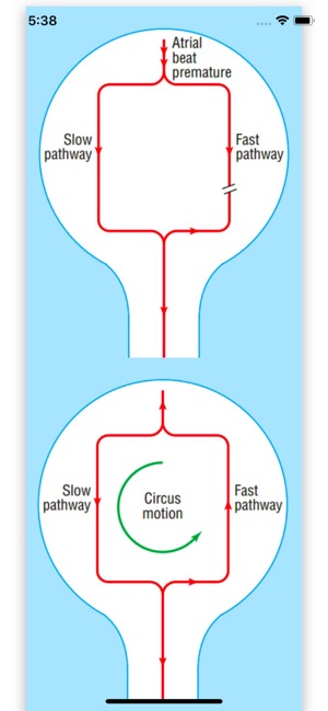 ECG Basics Pro - ECG Made Easy(圖3)-速報App